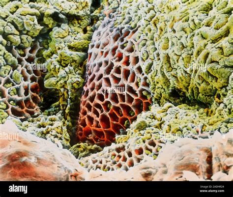 Gastric Ulcer False Colour Scanning Electron Micrograph Sem Of The