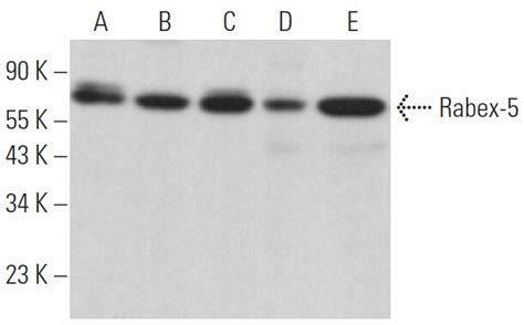 Rabex 5 Antibody A 7 Scbt Santa Cruz Biotechnology