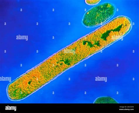 False Colour Transmission Electron Micrograph Tem Of The Bacterium