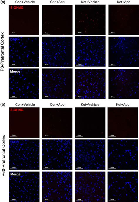 Immunofluorescence Staining To Detect 8 Ohdg In The Prefrontal Cortex Download Scientific