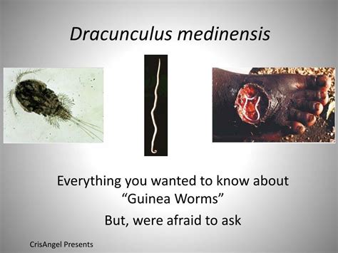 PPT - Dracunculus medinensis PowerPoint Presentation - ID:630005