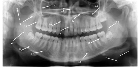 Solved Please Identify The Correct Anatomical Landmarks On Chegg