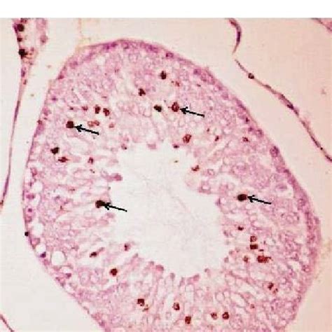 Photomicrograph Of Section In Testis Of Group Iiib Showing Moderate