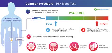 How To Lower Your Psa Level Safely And Effectively