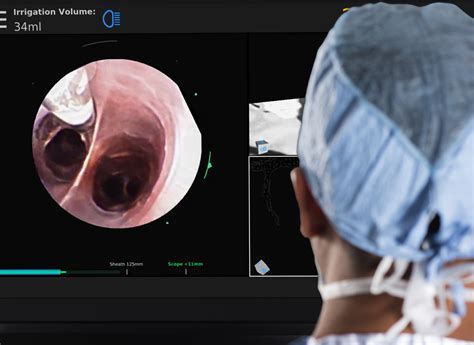 Monarch Robotic-assisted Bronchoscopy - Auris Health