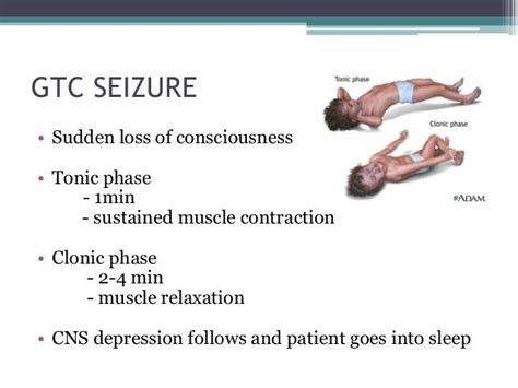 Anti Epileptic Drugs