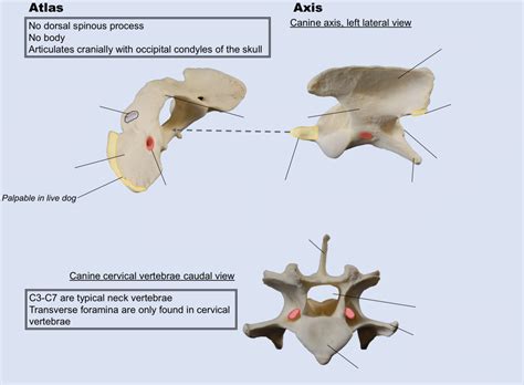 Diagram of Anatomy of the cervical vertebrae | Quizlet