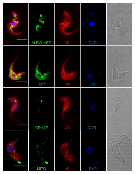 Knockdown Of Asparagine Synthetase A Renders Trypanosoma Brucei