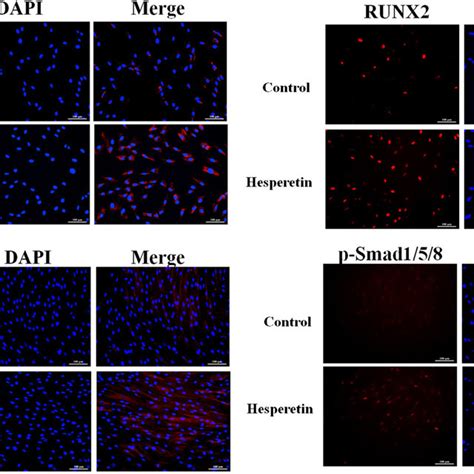 The Gene Expression Levels Of Alp Col1a1 Ocn And Runx2 In The