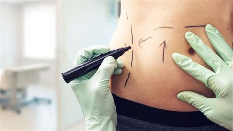 Does Laser Lipo Work Forbes Health