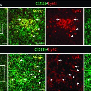 Detection Of Pmn Mdscs A And Mo Mdscs B Cells In Llc Cryosections