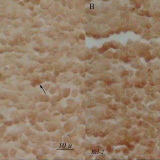 Light Photomicrographs Show Immunohistochemical Expression Of Bcl In