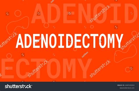 Adenoidectomy Surgical Removal Adenoids Stock Vector Royalty Free