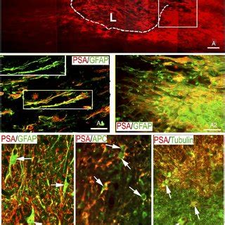 Expression Of Gfp In The Spinal Cord After Lv Gfp Injection All The