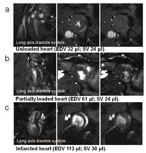 A Mri Cine Frames Long Axis Mid Ventricular Short Axis Diastole