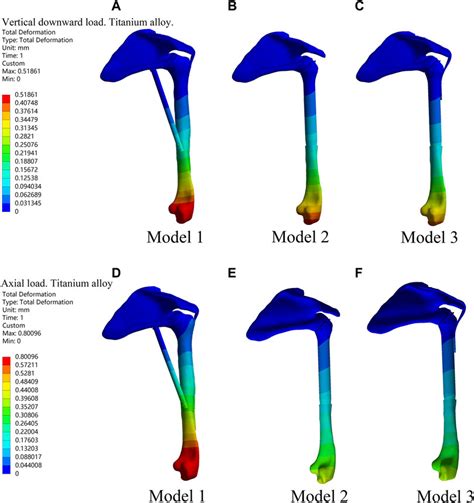 Frontiers Design And Validation Of A Novel 3D Printed Glenohumeral