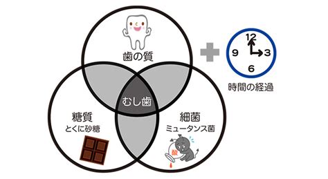 むし歯の原因と進行｜歯の健康基礎知識｜ライオン