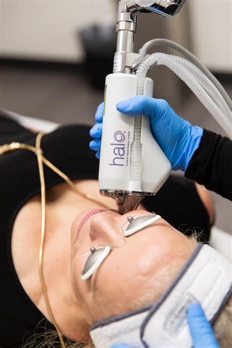 Halo Hybrid Fractional Laser Resurfacing Revitalize U