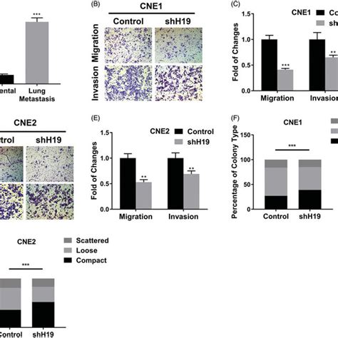 Lncrna H19 Promotes Migration And Invasion In Nasopharyngeal Carcinoma