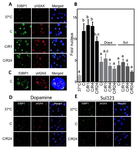 Immunofluorescent staining of γH2AX and 53BP1 A Nuclear foci of