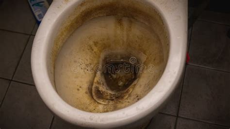 The Close Up View Of The Dirty Stain Inside Of The Toilet Bowl In The