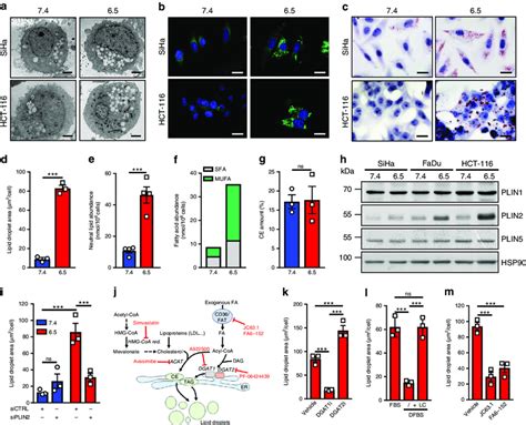 Acidosis Adapted Cancer Cells Exhibit Accumulation Of Lipid Droplets A Download Scientific