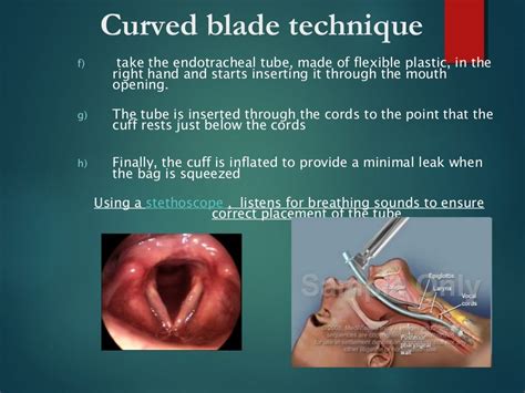 Pediatric Airway Chart