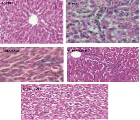 It Shows Photomicrographs Hande ×400 Of Various Liver Tissues From Download Scientific Diagram