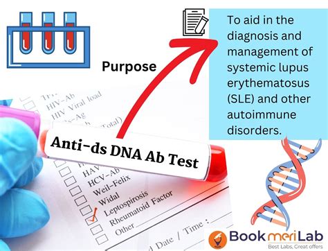 Anti dsDNA Test: Get Price, Purpose, Results & Sample Report [2025]