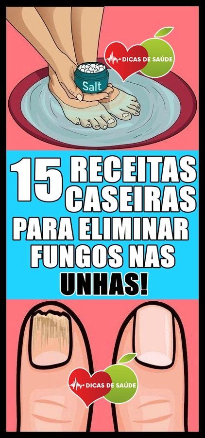 As 15 Receitas Caseiras Para Eliminar Fungos Nas Unhas Face E The