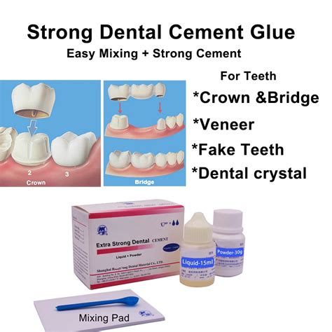 Permanent Dental Cement Glue Extra Strong For Teeth Crowns Bridge Extra