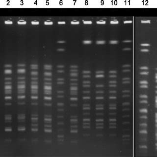 Examples Of Pfge Profiles Of E Coli Strains Lanes