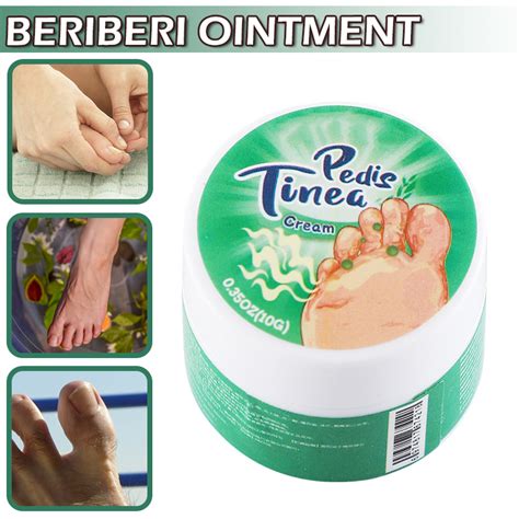 Pedis Tinea Cream Topical External Skin Itching Relief Natural Herbal