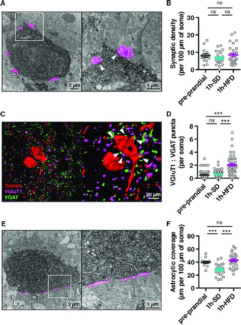 Neuroglial Interaction Of POMC Cre TdTomato Neurons Depends On The