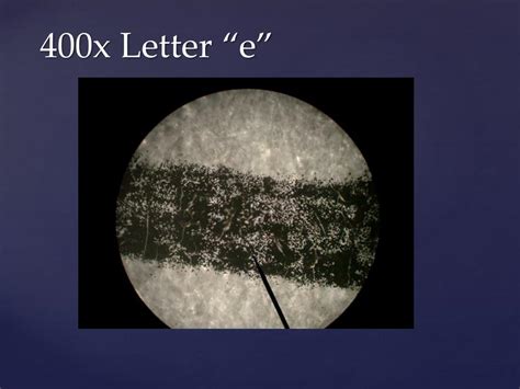 Letter E Under Microscope 400x Micropedia