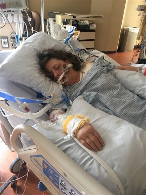 Portland Woman Victim Of Freak Accident Talks To Koin