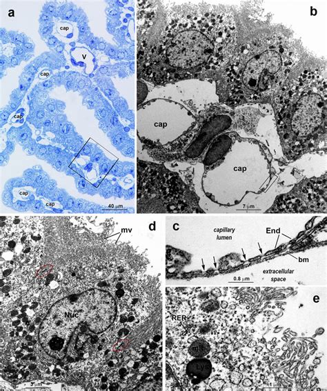 Morphological Aspects Of The Lateral Ventricle Choroid Plexus From A