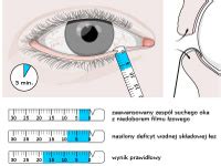 Przyczyny Nadmiernego Mrugania Pediatria Mp Pl