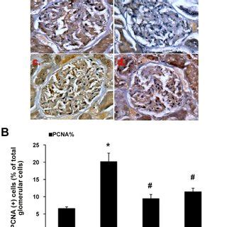 Immunohistochemical Staining Of PCNA In The Glomerulus Kidneys From