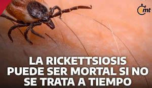 Noticias De Rickettsiosis En Mediotiempo