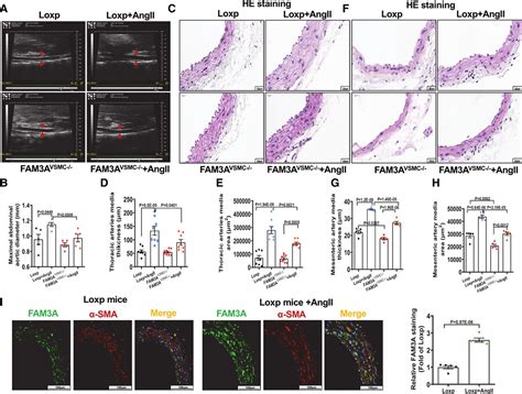 VSMC Specific Deletion Of FAM3A Attenuated Ang II Promoted Hypertension