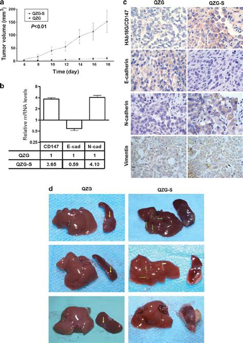 HAb18G CD147 Enhanced Tumor Growth And Tumor Metastasis In Vivo A