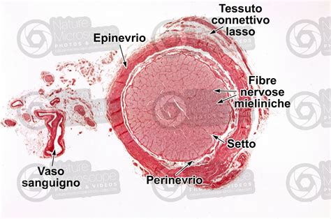 Mammifero Nervo Ottico Sezione Trasversale 32X Nervo Ottico