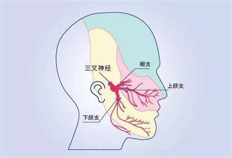 神外专家带你了解三叉神经痛的分类及症状表现 微医（挂号网）