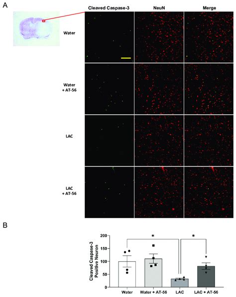 Effect Of AT 56 On Cleaved Caspase 3 Positive Neurons In The Cerebral