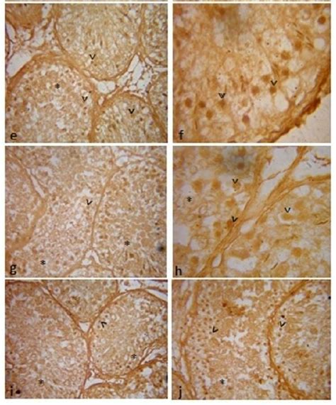 Microphotographs Showing Apoptosis Via Tunel Assay In Testicular Germ