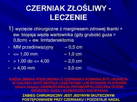 Czerniak Z O Liwy Melanoma Malignum Ppt Pobierz