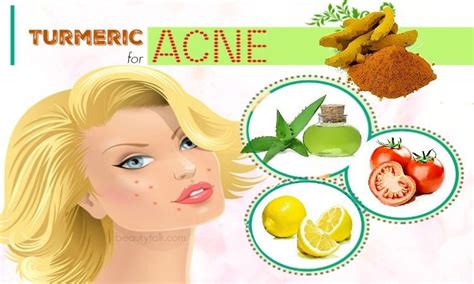 15 Approved Ways On How To Use Turmeric For Acne Treatment