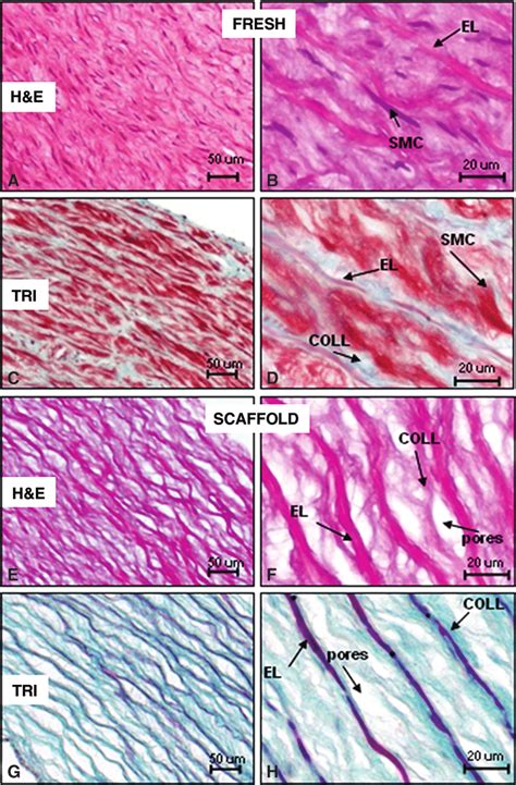 Characteristics Of Acellular Porcine Elastin Scaffolds Derived From Download Scientific Diagram