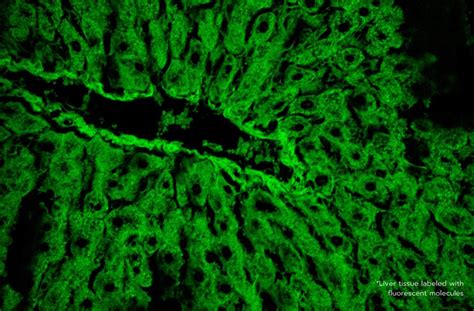 Cell-Based Regeneration and Treatment of Liver Diseases